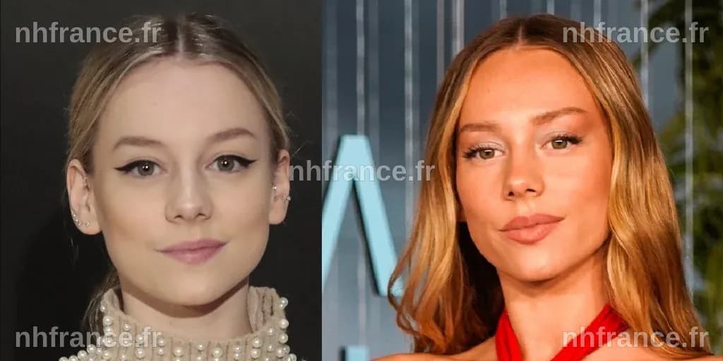 Ester Expósito avant la chirurgie.