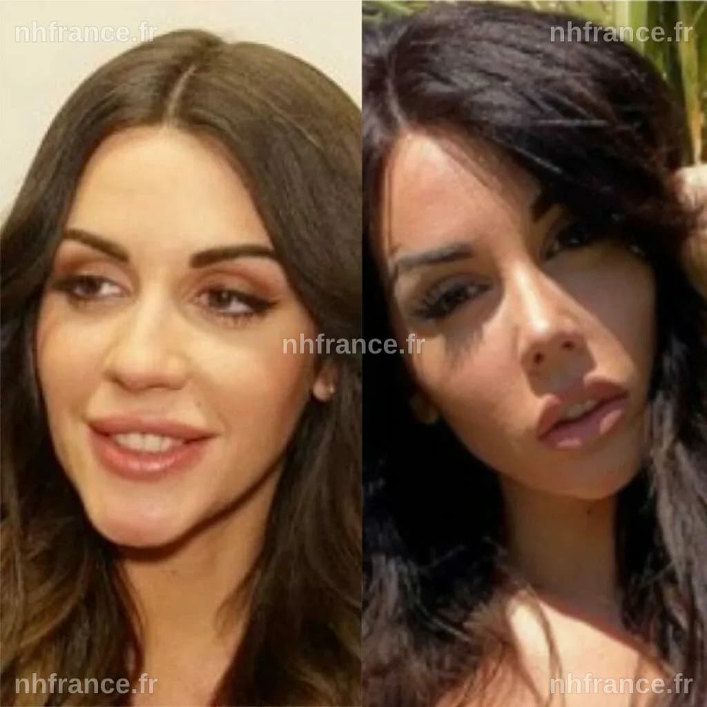 Transformation de Laura Lempika