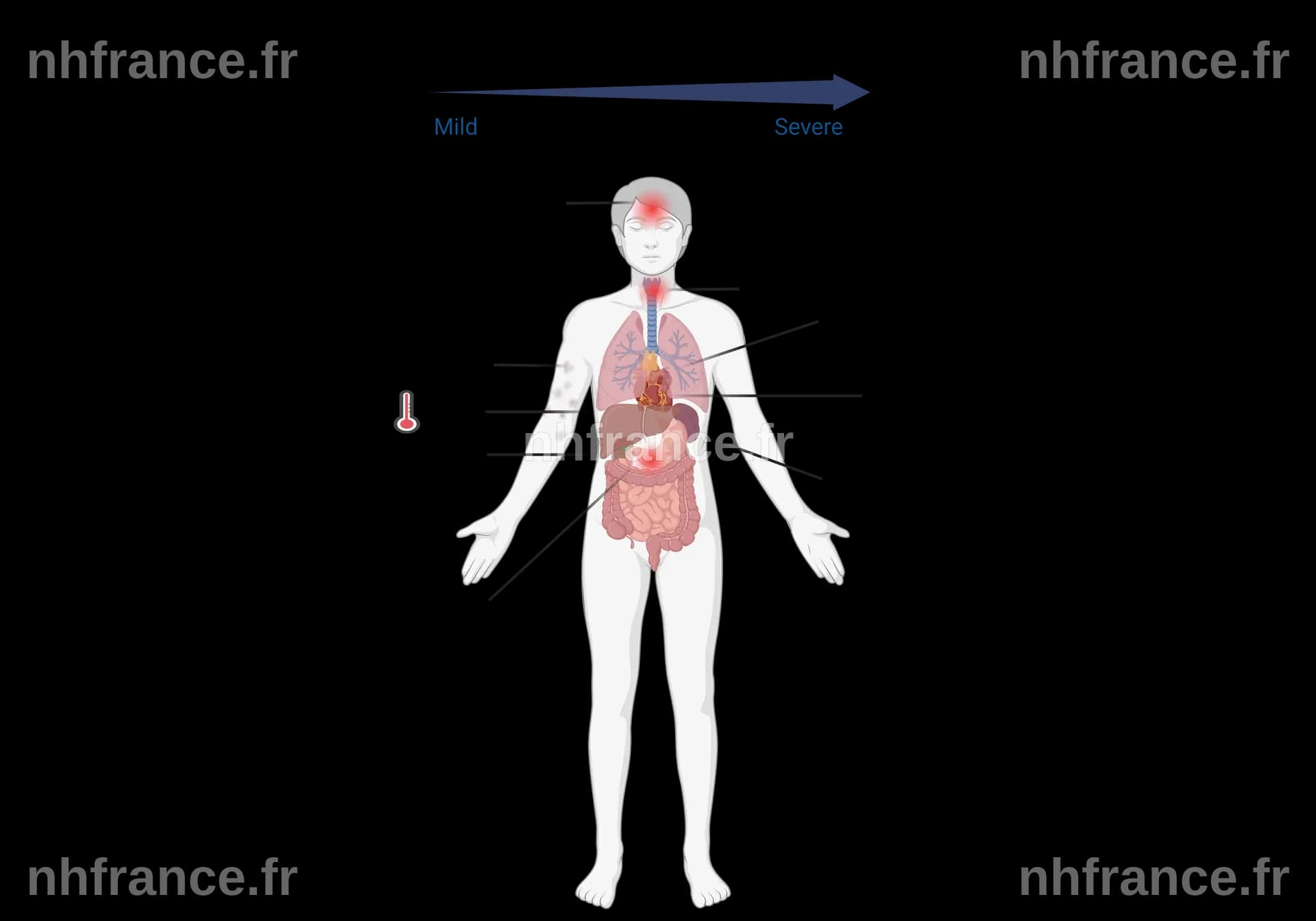 Une passagère évacuée teste positif au hantavirus, une autre présente des symptômes lors du vol retour